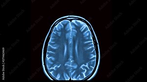 MRI timelapse brain scan,magnetic resonance imaging of a brain, ultra hd 4k, time lapse