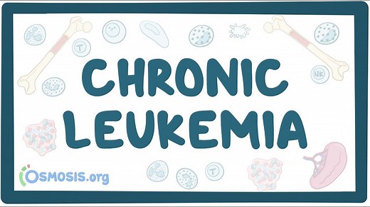 Chronic leukemia: Video, Causes, & Meaning | Osmosis