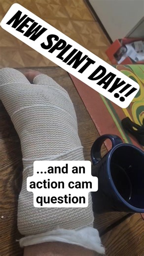 New Splint! Day 4 Post-Op