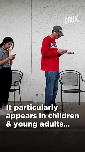 3.4K views | Experts suggest that the presence of purple or blue lesions on a patient’s feet and toes is puzzling, however since the virus is in its early stages, COVID toes patients are more likely to test negative for COVID-19 | News18 | Facebook