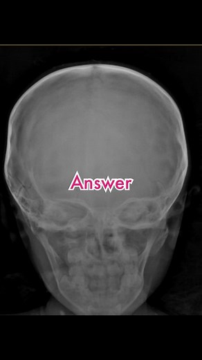 Dr Azku | Radiologist on TikTok