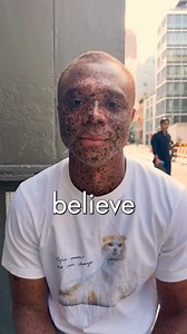 “I experienced rejection throughout my entire life” - Ralph, Brooklyn ♥️ | Dose of Society