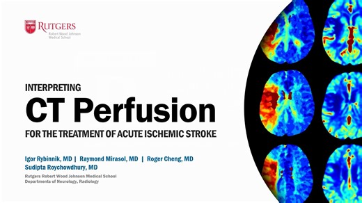CT Perfusion In Acute Ischemic Stroke