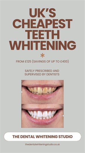 Exclusive Teeth Whitening Launch in Manchester!