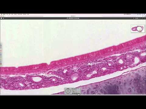 Histology of the trachea