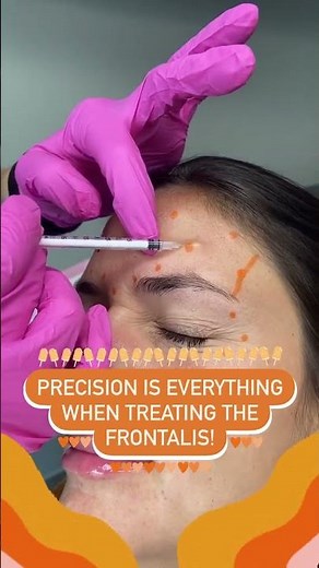 Precision is Everything when Treating the Frontalis