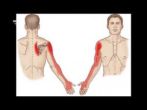 Elbow Pain | Causes & Treatments | Physiotherapy 4 all