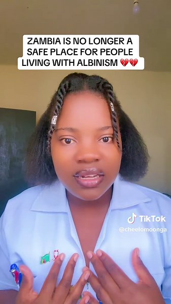 25-Year-Old Albino Man Killed in Suspected Ritual Murder A 25-year-old man living with albinism in Lyuchi Village in Chief Waitwika's area in Nakonde District, Micheal Simuntala has been brutally murdered in what is suspected to be a ritual killing. According to police details, Michael was last seen alive on Friday, February 22, 2025, around 17:00 hours, when he was requested by his friends, identified as Willard Sinkala, Chimwemwe Ng'andu, and Misheck Simukonda, to escort them to a nearby villa