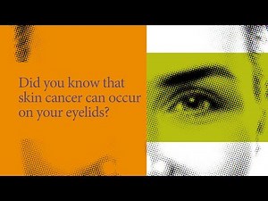 Three tips for eyelid cancer prevention