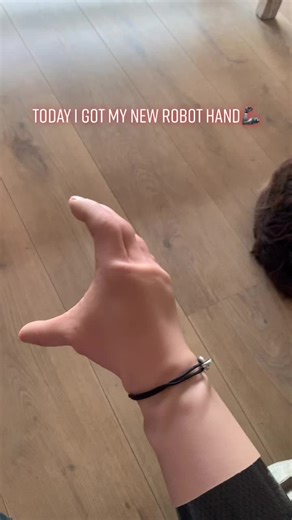 Today i got my new robot hand 🦾. #bebionic #fakehand #prosthetic #prosthetichand #ottobock #prostheticarm