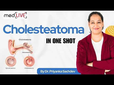 Cholesteatoma Explained: Etiology, Pathogenesis & Management | ENT | Dr. Priyanka Sachdev