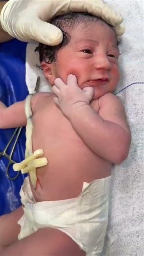 Essential care of baby 💗 After Birth #adoreble#cutebabies #baby #adorably #cute