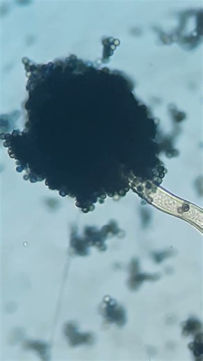 Aspergillus niger in LPCB #microscope #shorts