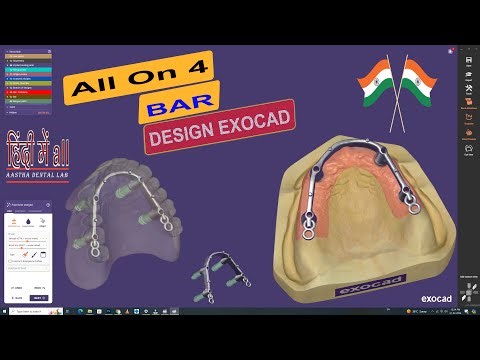 All On 4 Design with Screw Retained Bar Split File [ Exocad 3.1Tutorial ] 🦷