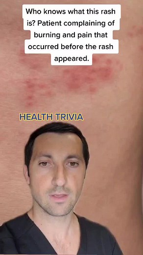 Identifying Common Skin Rashes: Test Your Knowledge