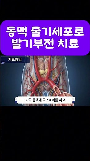 [제목] 수술 없이 되찾는 자신감? 발기부전, 이제 '줄기세포'로 근본부터 치료하세요!