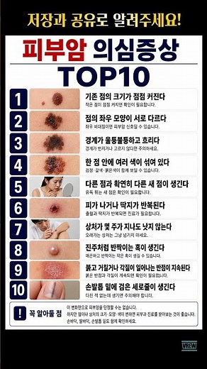 놓치면 안되는 [피부암 의심증상] TOP10 #피부암#피부암증상#악성흑색종#흑색종#암