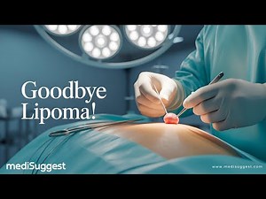 Painless Lipoma Removal? The Truth About the Procedure