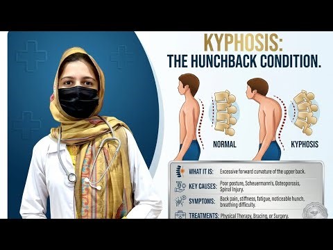 The Hidden Dangers of Kyphosis: From Chronic Pain to Breathing Issues