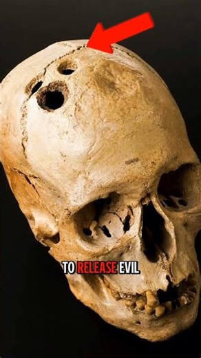 Strange medical practices from history