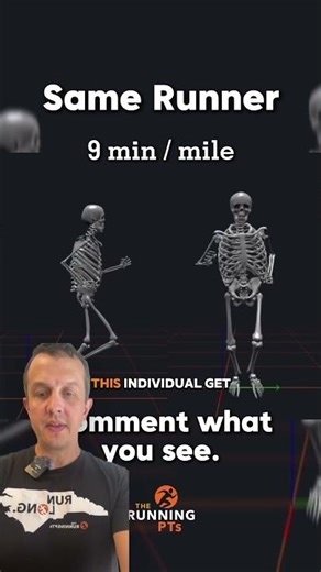 Shin Splints from Overstriding (Runner Fix)