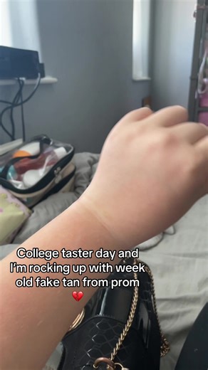 Prom Night Faux Tan Disaster