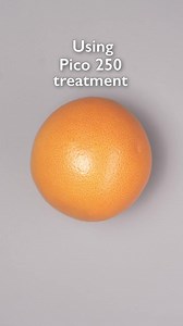 5.6K views · 23 reactions | Skin changes – freckles, acne scars, and enlarged pores are problems that can affect self-esteem  Eliminate these stubborn issues with the world’s fastest Pico250 that is extremely safe & gentle to skin. | One Doc | Facebook