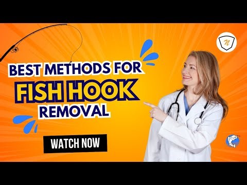 How to Remove A Fish Hook: The 2 BEST Methods!