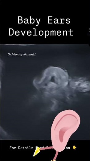 Baby Ears Development In Pregnancy seen On Ultrasound Scan