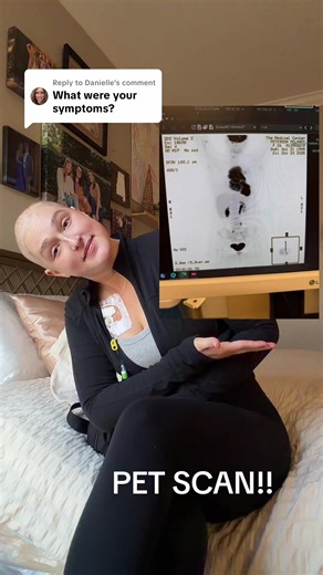 Replying to @Danielle POV: Connecting all the cancer signs and symptoms I swore were ‘just stress.’ Here’s your sneak peek at the PET scan that said ‘girl… no. #creatorsearchinsights #chemo #lymphoma #pmbcl #cancer