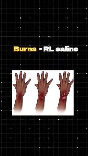 Fluids in Diseases / Hydration #nursing #nurse #medical #hospital#emergency