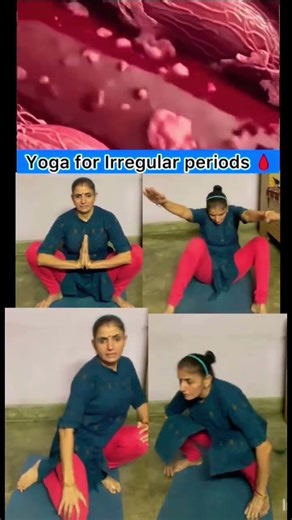 painful menstruation?🧘🏻‍♀️🩸 #yogawithjuhii #motivation #yoga #viral #dailyyoga #irregularperiods