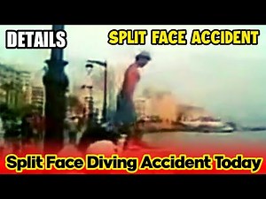 Split Face Diving Accident Today | DETAILS | face split diving accident | split face accident