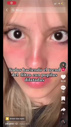 Effects of Dilated Pupils on Vision | Visual Experience Explained