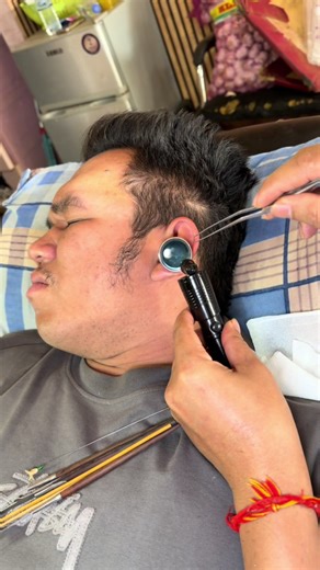 Ear Wax Removal ASMR Videos for Relaxation