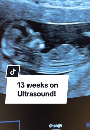 13 Weeks Pregnant: Ultrasound, Baby Size, and Development