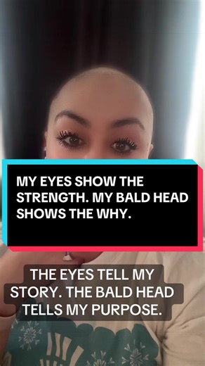 I’M A 15 YEAR CANCER SURVIVOR. EVERY TIME I SHAVE MY HEAD, IT’S FOR SOMEONE STILL FIGHTING CANCER. YOU MIGHT NOTICE MY EYES FIRST… BUT THE BALD HEAD IS THE REAL MESSAGE. I STAND WITH WARRIORS. #cancertok #cancer #cancersucks #cancerwarrior #cancersurvivor