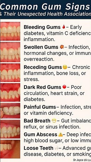 Your Gums are warning you. 9 Common Gum Signs & Their Unexpected Health Associations#shorts #health