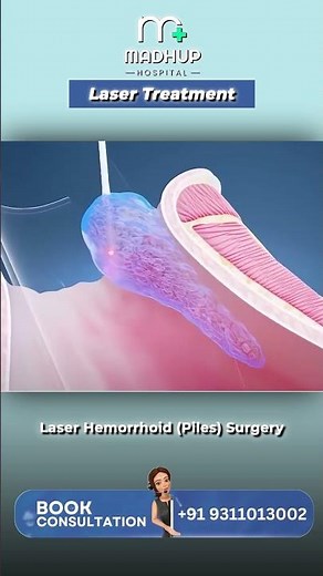 Laser Hemorrhoid Surgery | Painless & Fast Recovery Treatment at Madhu Hospital #lasertherapy