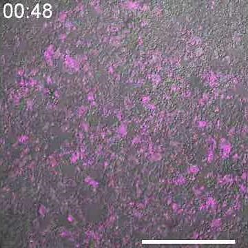 細胞性粘菌キイロタマホコリカビとムラサキタマホコリカビの共集合・種間認識