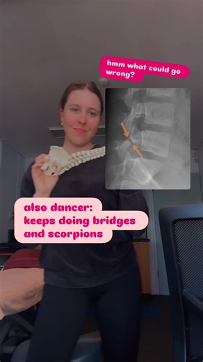 Anastasia Sotnikova | Dance Physio & Exercise Physiology on Instagram: "Feeling pain during bridges or backbends? 🚨 Your spine is trying to tell you something. Pain isn’t just ‘tight muscles’, it could mean your joints, discs, or muscles are struggling to handle the load. Ignoring it can lead to bigger injuries down the line. Listen, assess, and strengthen safely. Your back will thank you! 💪🩰 One common issue dancers face is a pars stress reaction. This occurs when the small bony segment in t