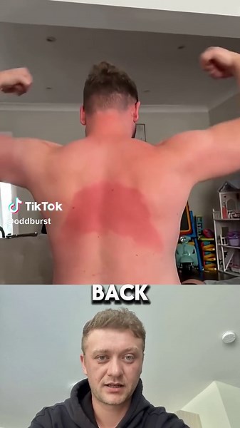 Avoiding Sunscreen Fails: Tips for Perfect Application