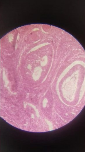 V.S of mammalian ovary under compound microscope 🔬 || Class XII/12 Biology practical || Spotting