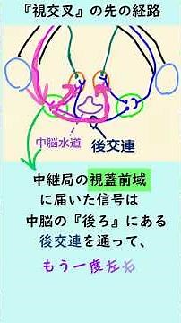 "Complete Guide to the Light Reflex Route - Pay Attention to the Back Side of the Midbrain" #Orth...