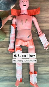 76K views · 1.3K reactions | Broken bone? Try this… | US Headlines | Facebook