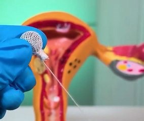 How Common Medical Procedures Actually Work