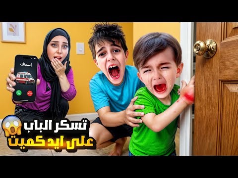 كموتة تسكر الباب على ايدو😱ايدو انتفخت وأخذنا اسعاف 🚨 خلودة كتير زعل عليه🥲