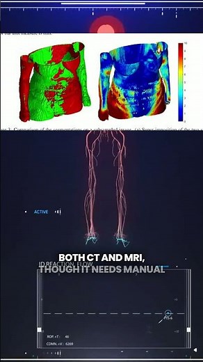 AI vs Algorithm in 3D Skin Segmentation: Who Wins?