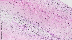 Section of man transitional epithelium filmed under microscope 200x on bright field. Isolated macro of tissue consisting of multiple layers of cells. Discovering body parts with high magnification