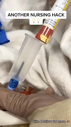 another nurse hack🤪 credit @ nursebrat via tiktok 👏 #iamanurse #nightshiftnurse #nurselife #instanurse #nursehack #nursinghacks | I'm Proud to be a Nurse